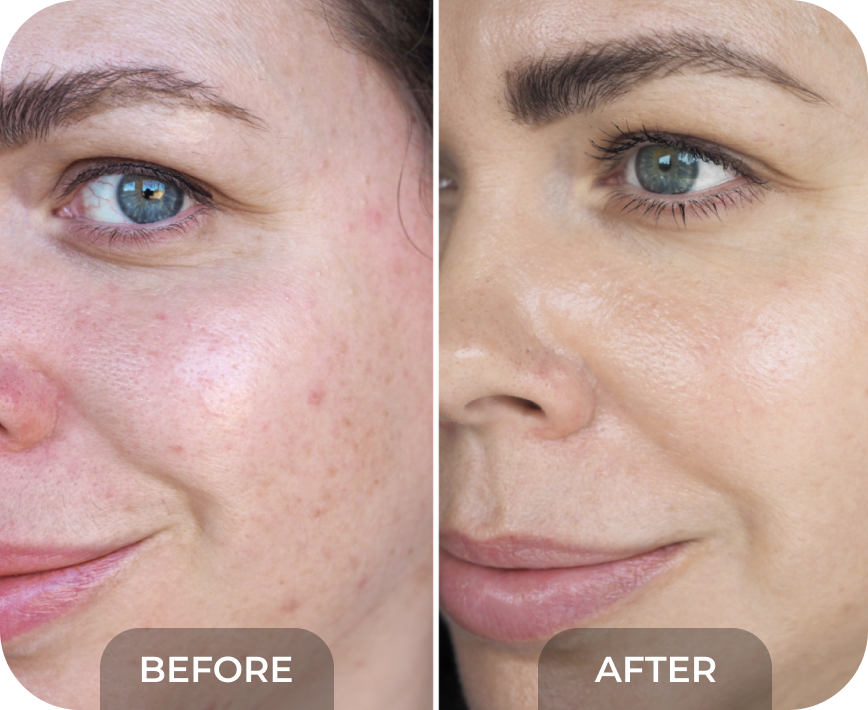 My Derma Dream – MyDermaDream